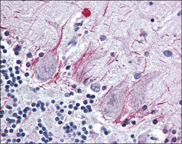 Anti-PTH2R / PTHR2 antibody produced in rabbit