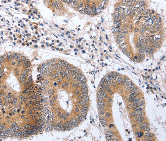 Anti-PSPN antibody produced in rabbit