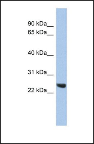 Anti-PSMB2 antibody produced in rabbit