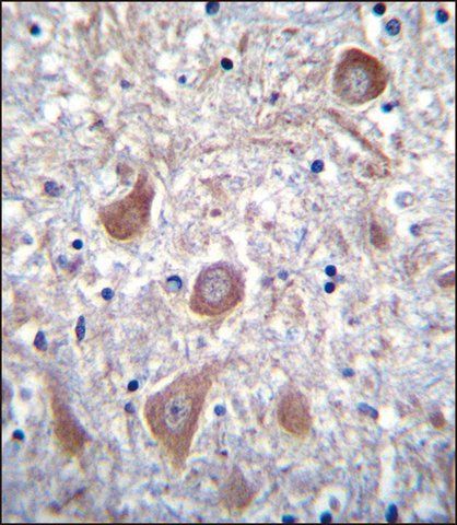 ANTI-PTCHD1 (CENTER) antibody produced in rabbit