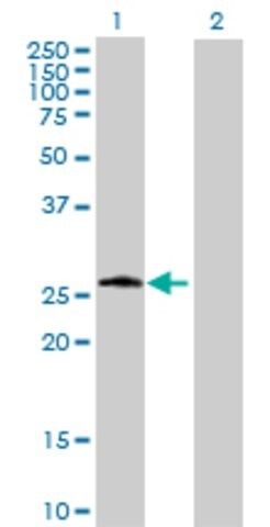 ANTI-PSPH antibody produced in mouse