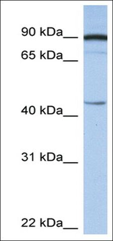 Anti-PSMD6 (AB1) antibody produced in rabbit