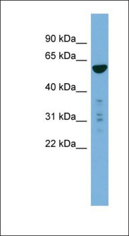 Anti-PTDSS2 antibody produced in rabbit