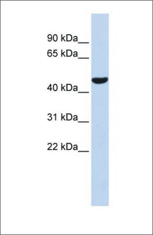 Anti-PTGIS antibody produced in rabbit