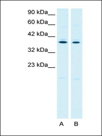 Anti-PTGER3 antibody produced in rabbit