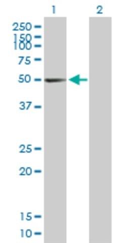 Anti-PTGIS antibody produced in mouse