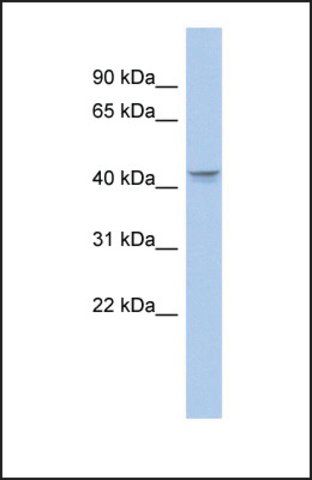 Anti-PTGER3 antibody produced in rabbit