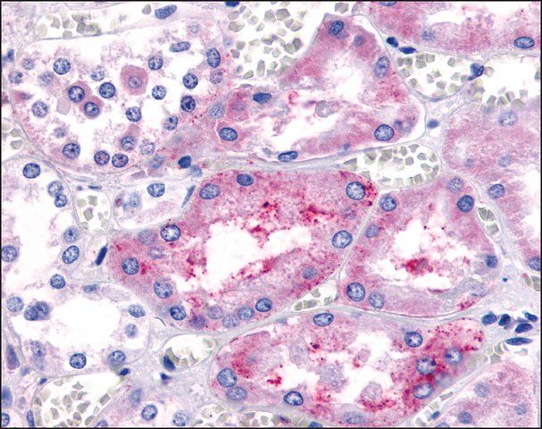 Anti-PTGER1 / EP1 antibody produced in rabbit