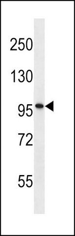 ANTI-PTHD2 (N-TERM) antibody produced in rabbit