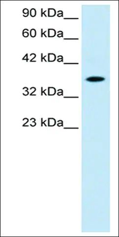 Anti-RAX (AB1) antibody produced in rabbit