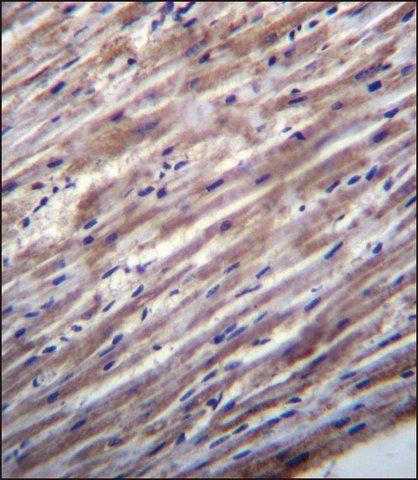 ANTI-RASD1 (C-TERM) antibody produced in rabbit