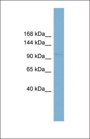 Anti-RBBP8 antibody produced in rabbit