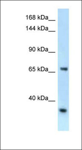 Anti-RBM15B antibody produced in rabbit