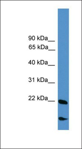 Anti-RBM18 antibody produced in rabbit