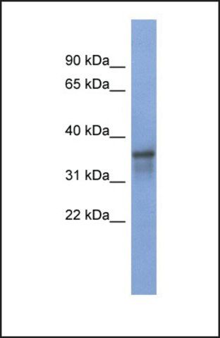 Anti-RBM9 antibody produced in rabbit