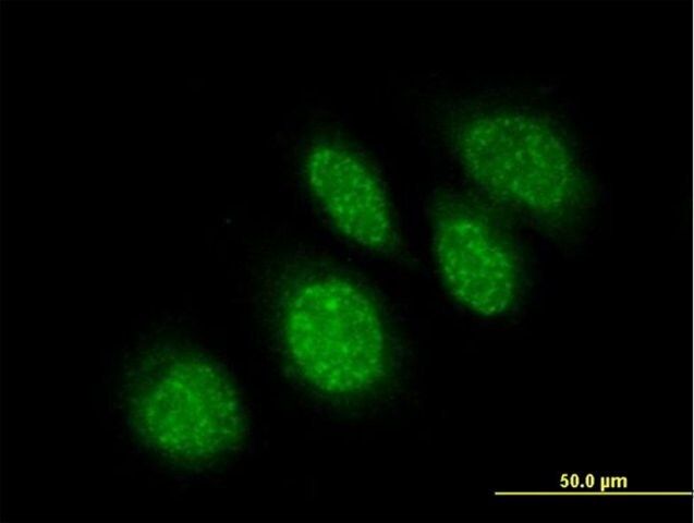 Anti-RBBP9 antibody produced in mouse