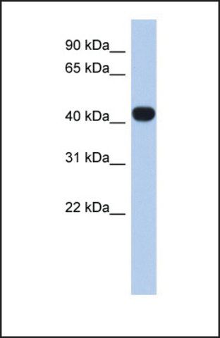 Anti-RASGEF1C, (N-terminal) antibody produced in rabbit