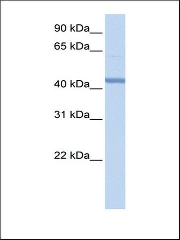 Anti-RBM22 (AB1) antibody produced in rabbit