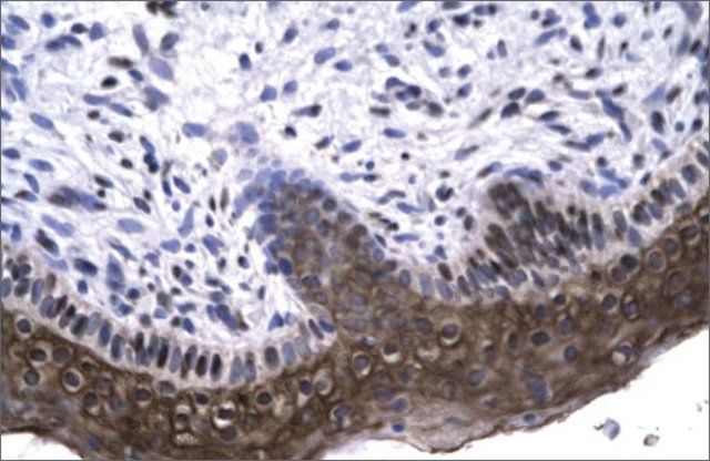 Anti-RAX (AB2) antibody produced in rabbit