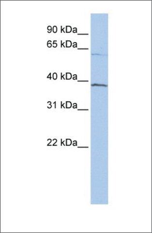 Anti-RBBP5 antibody produced in rabbit