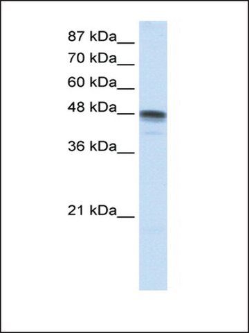 Anti-RBMS3 (AB1) antibody produced in rabbit