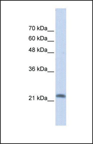 Anti-RASL10A, (N-terminal) antibody produced in rabbit