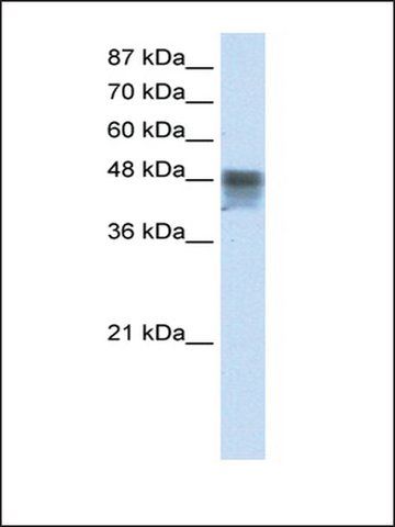 Anti-RBMS3 (AB2) antibody produced in rabbit