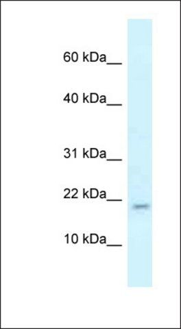 Anti-RBM3 antibody produced in rabbit