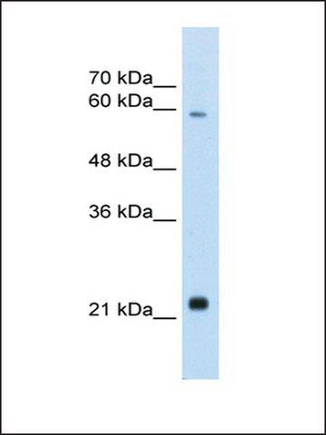 Anti-RBPJL antibody produced in rabbit