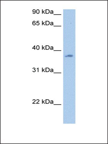 Anti-RBMY1A1 antibody produced in rabbit