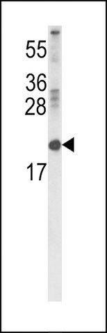 ANTI-RBP2 (CENTER) antibody produced in rabbit