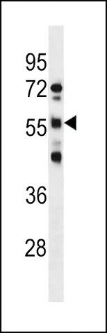 ANTI-RBMY1D(C-TERMINAL) antibody produced in rabbit