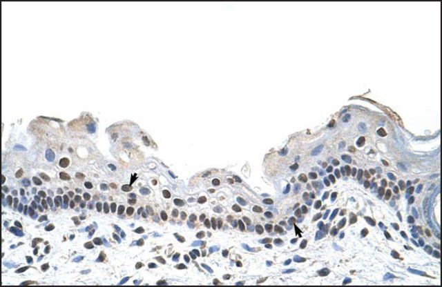 Anti-RBM28 antibody produced in rabbit