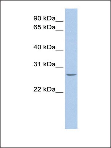 Anti-RBPMS (AB1) antibody produced in rabbit