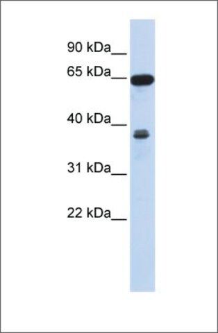 Anti-RCC2 antibody produced in rabbit