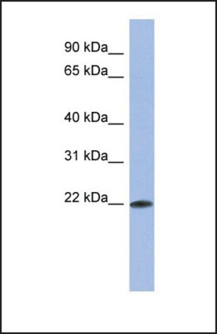 Anti-RBM38 antibody produced in rabbit