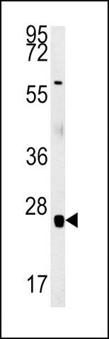 ANTI-RBM24 (N-TERMINAL) antibody produced in rabbit