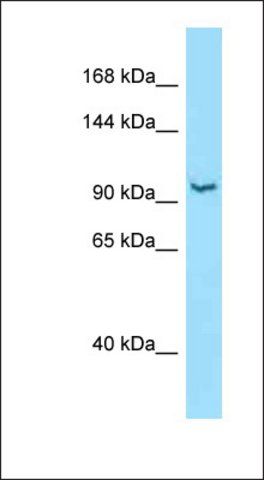 Anti-RBM25 antibody produced in rabbit