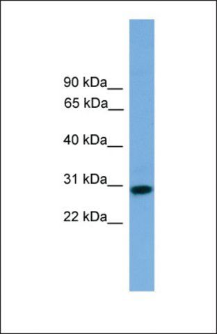 Anti-RCAN2 antibody produced in rabbit