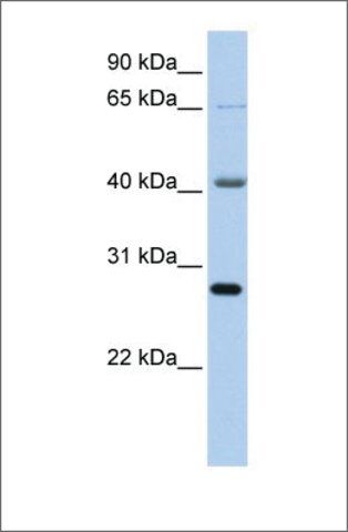 Anti-RBM34 antibody produced in rabbit