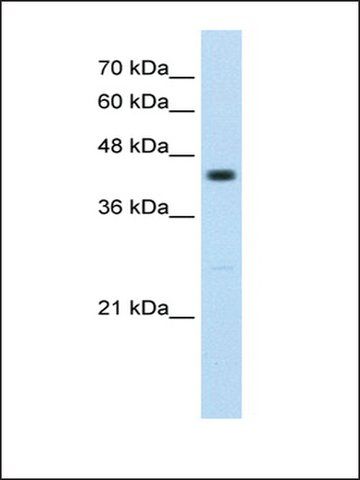 Anti-RNF32 antibody produced in rabbit