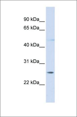 Anti-RNF170 antibody produced in rabbit