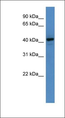 Anti-RNF128 antibody produced in rabbit