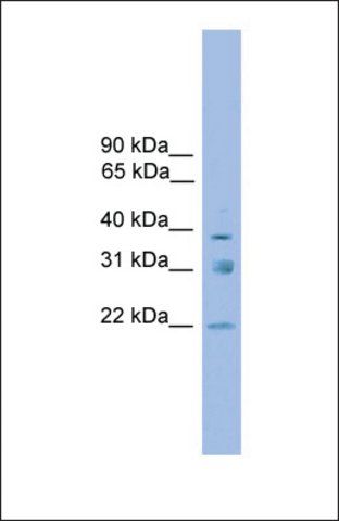 Anti-RNF167 antibody produced in rabbit