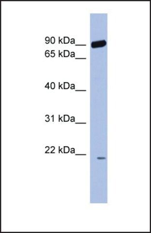 Anti-RNF135 antibody produced in rabbit