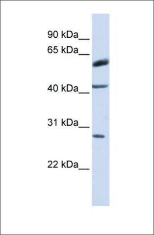 Anti-RNF170 antibody produced in rabbit