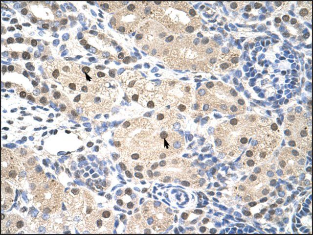 Anti-RNF14 antibody produced in rabbit