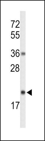 ANTI-RNH2C (CENTER) antibody produced in rabbit