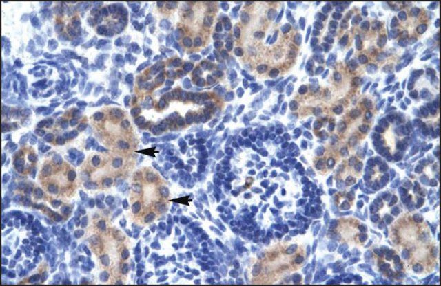 Anti-RNF141 antibody produced in rabbit