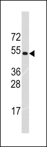 ANTI-RNF36 (TRIM69) (CENTER K251) antibody produced in rabbit